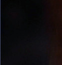 Ũ1